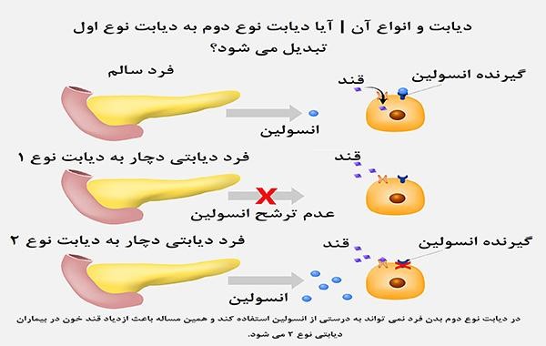 انواع دیابت در سالمندان