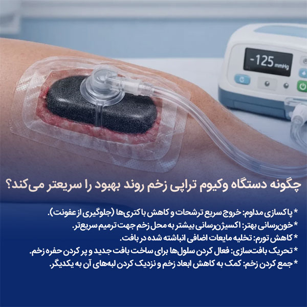 مزایای استفاده از دستگاه وکیوم تراپی زخم