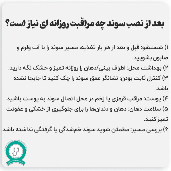 بعد از نصب سوند، چه مراقبت‌های روزانه‌ای نیاز است؟