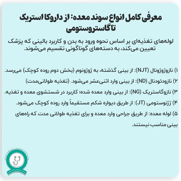 سوند معده چیست؟