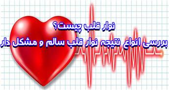 نوار قلب چیست و چه کاربردی دارد؟
