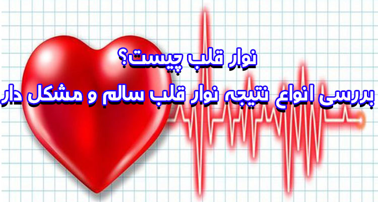 نوار قلب چیست؟