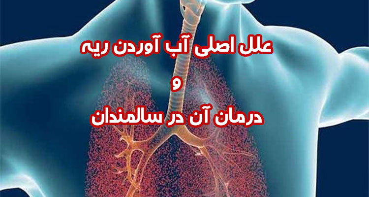 آب آوردن ریه