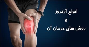 انواع آرتروز و روش های درمان